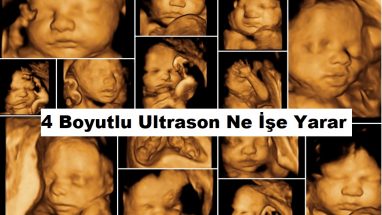 4 Boyutlu Ultrason Ne İşe Yarar