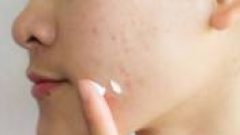 Kuru Cilt İçin 5 Öneri Tavsiyesi