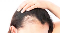 Saç Dökülmesine İyi Gelen Yağlar Nelerdir