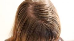 Saçları Kalınlaştırma Yöntemleri 5 Yol