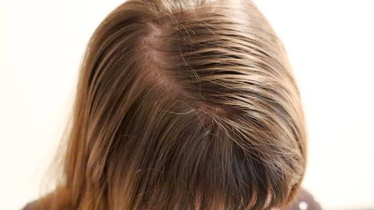 Saçları Kalınlaştırma Yöntemleri 5 Yol