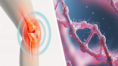 Glucosamine Ne İşe Yarar Faydaları Nelerdir